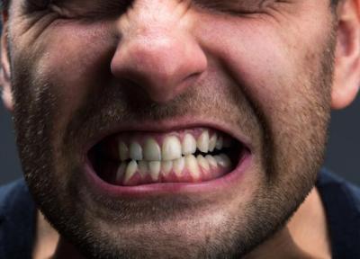 دندان قروچه (بروکسیم) چیست؟ دلیل ایجاد و برترین درمان های خانگی برای آن کدام است؟