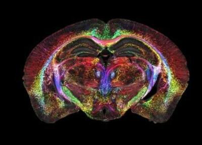 ثبت واضح ترین عکسی که از مغز دیده اید